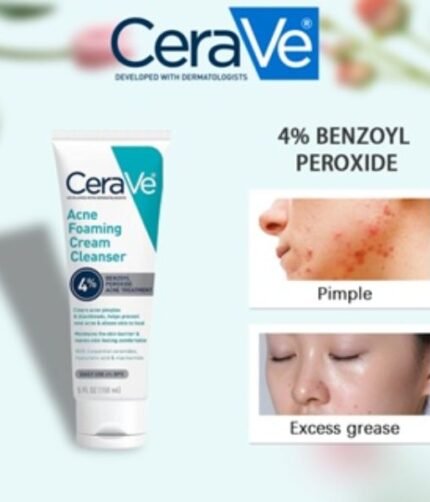 Acne Foaming Cream Wash Price In Pakistan