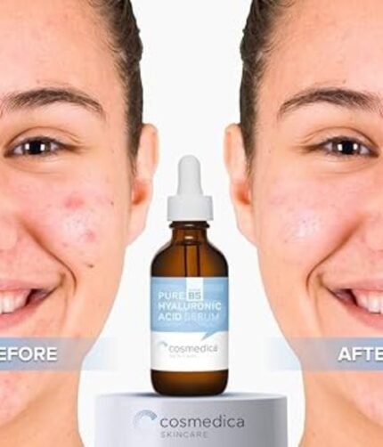 Cosmedica Hyaluronic Acid Serum in Pakistan
